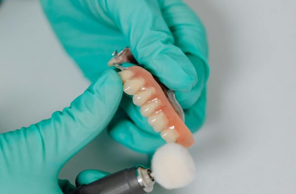 Rehabilitación Oral