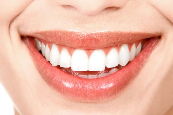 diseno-de-sonrisa-dentioral