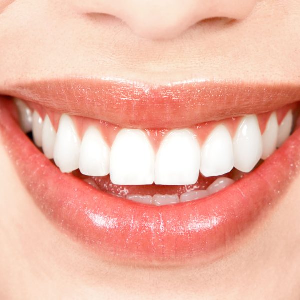 diseno-de-sonrisa-dentioral diseno-de-sonrisa-dentioral